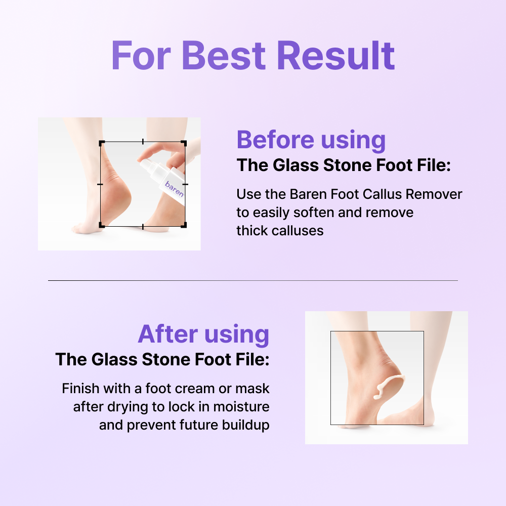 MagicGlass Stone Foot file - Γυάλινη Λίμα Ποδιών Διπλής Όψης για Κάλους & Σκληρύνσεις