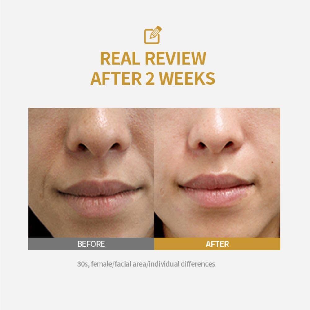 Silk Peptide Intensive Lifting Ampoule - Αμπούλα με 3-πλό σύστημα lifting