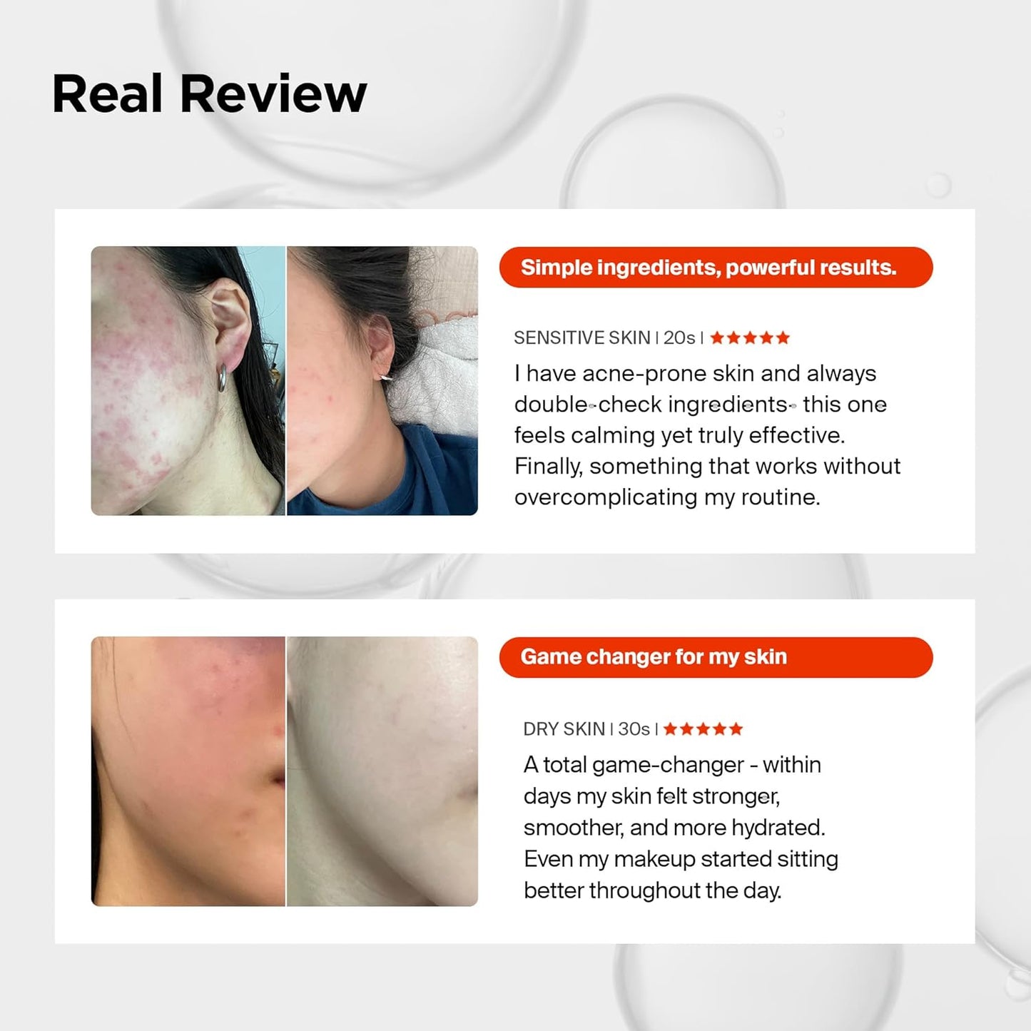 Pixcell BIOM™ 2Billion/ml Serum - Ορός Ενίσχυσης Μικροβιώματος & Επιδερμιδικού Φραγμού