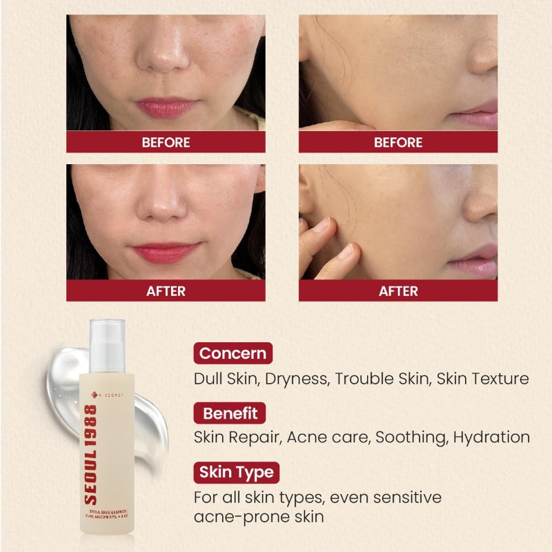 SEOUL 1988 Essence : Snail Mucin 97% + Rice - Ενυδατικό essence για αναζωογόνηση και ανανέωση