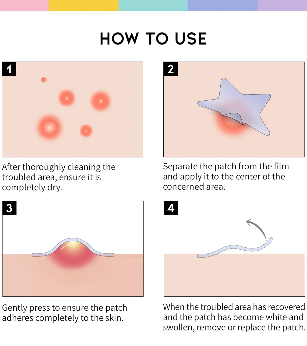 Star Spot Patch - Επιθέματα με Νιασιναμίδη & Ceramide για γρήγορη θεραπεία σπυριών