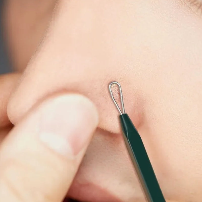Pimple Extractor - Εργαλεία για τη αφαίρεση σμήγματος