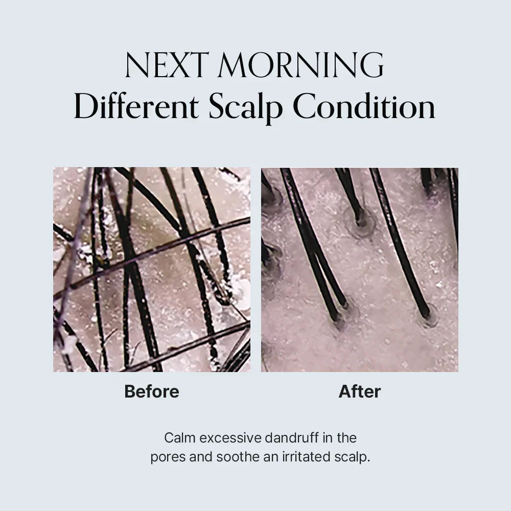 Damage Therapy Scalp Ampoule - Εντατική Θεραπεία για Υγιές Τριχωτό & Πιο Πλούσια Μαλλιά