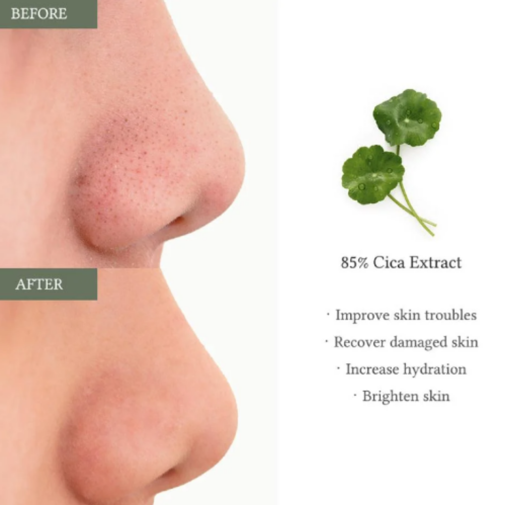 2% Salicylic Acid Clear Pad - Απολεπιστικά Pads Καθαρισμού Πόρων & Κατά της Ακμής