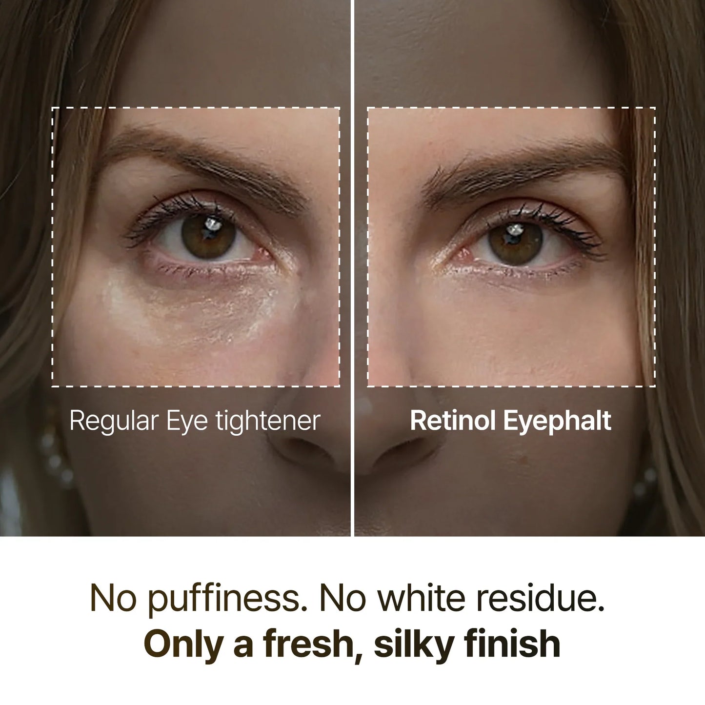 Retinol Eyephalt Eyebag Cream – Κρέμα Ματιών με Ρετινόλη για Μείωση Μαύρων Κύκλων & Σακούλων