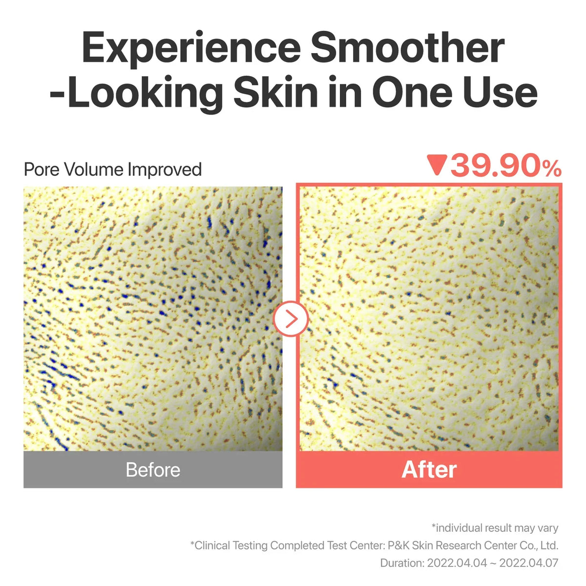 No.3 Tingle-Pore Softening Sheet Mask – Μάσκα Προσώπου για Πόρους & Λείανση με Bifida και Galactomyces