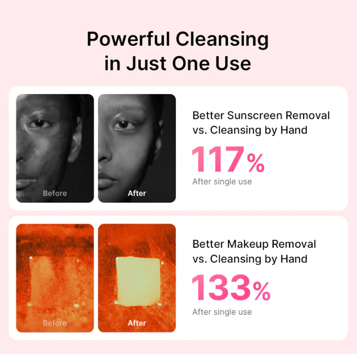 AGE-R Booster Cleanser Head (Pink) - Κεφαλή Καθαρισμού Προσώπου για το AGE-R Booster Pro Mini Plus