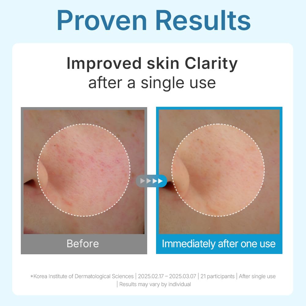Hyal Waterfull Glow Gel Mask - Ενυδατική Hydrogel Μάσκα Λάμψης με 10 Τύπους Υαλουρονικού Οξέος
