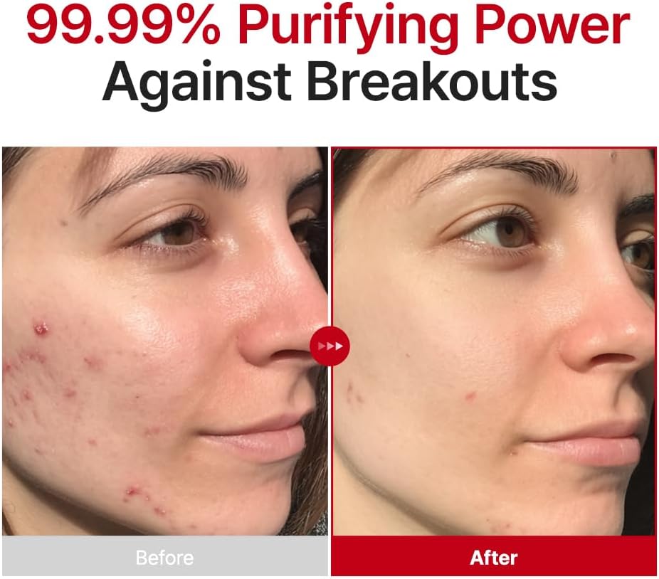 Hypochlorous Acid Rescue Spray - Καθαριστικό & Καταπραϋντικό Mist με HOCl & Witch Hazel