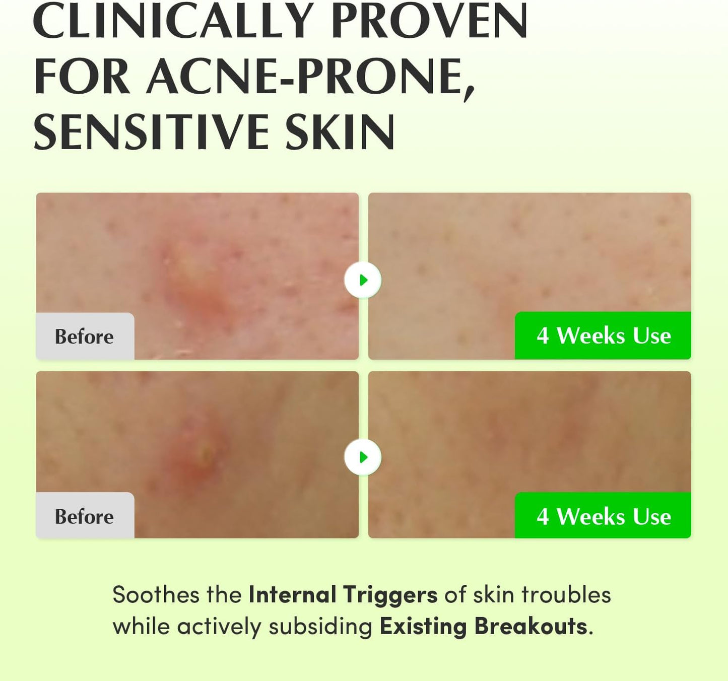 Aloe PDRN Calming Toner – Καταπραϋντική & Ενυδατική Τονωτική Λοσιόν