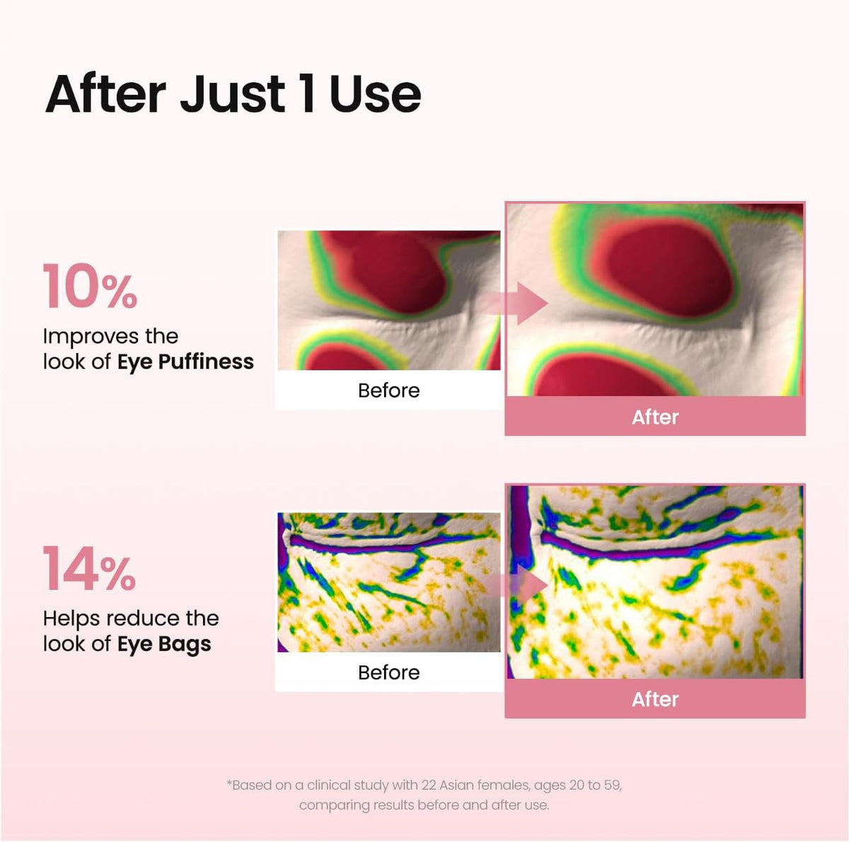 Collagen Eye Patches – Patches Ματιών με Κολλαγόνο, Πεπτίδια & Καφεΐνη