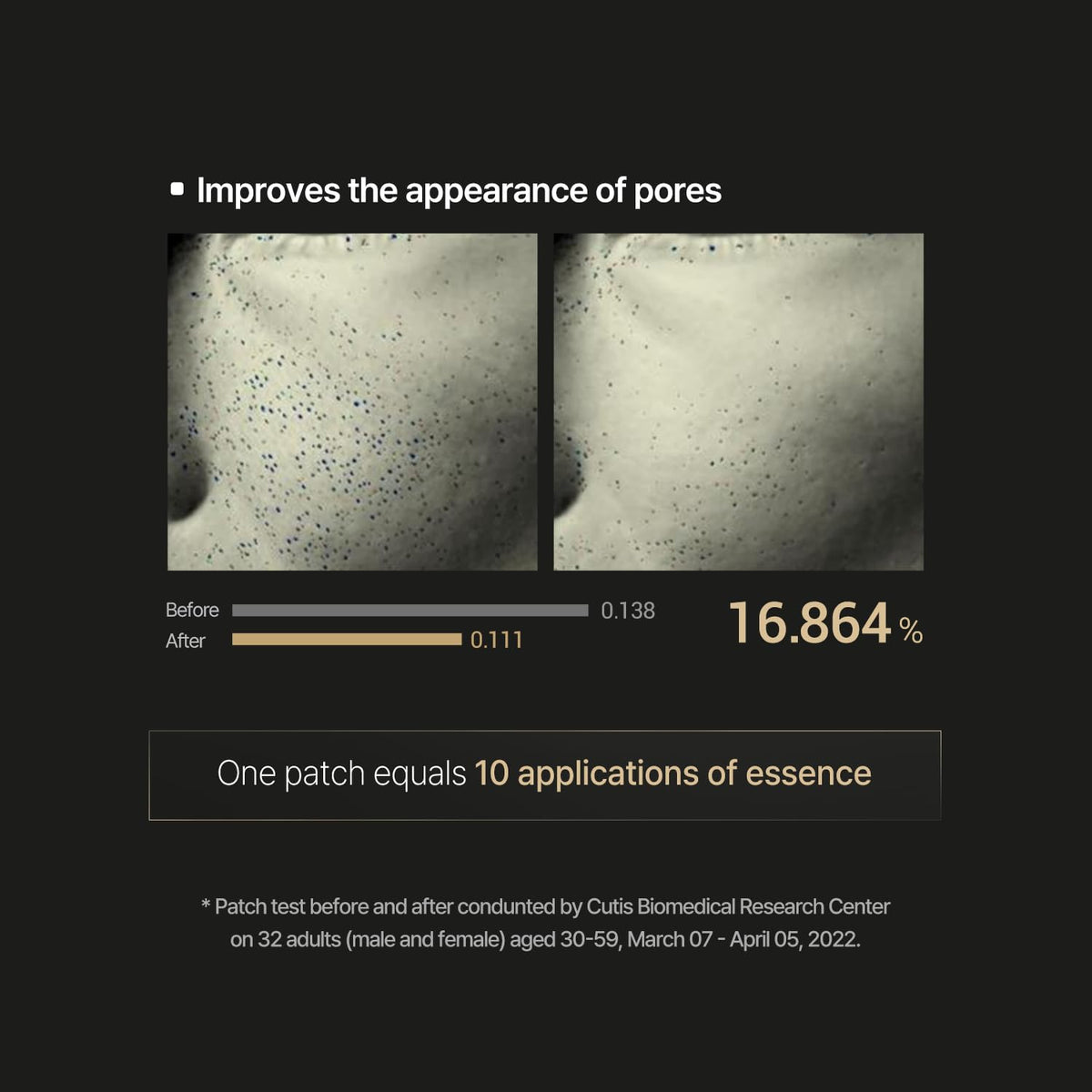 Retinol Microcone Patch Slim Type – Microcone Patches με Ρετινόλη & Υαλουρονικό για Ρυτίδες