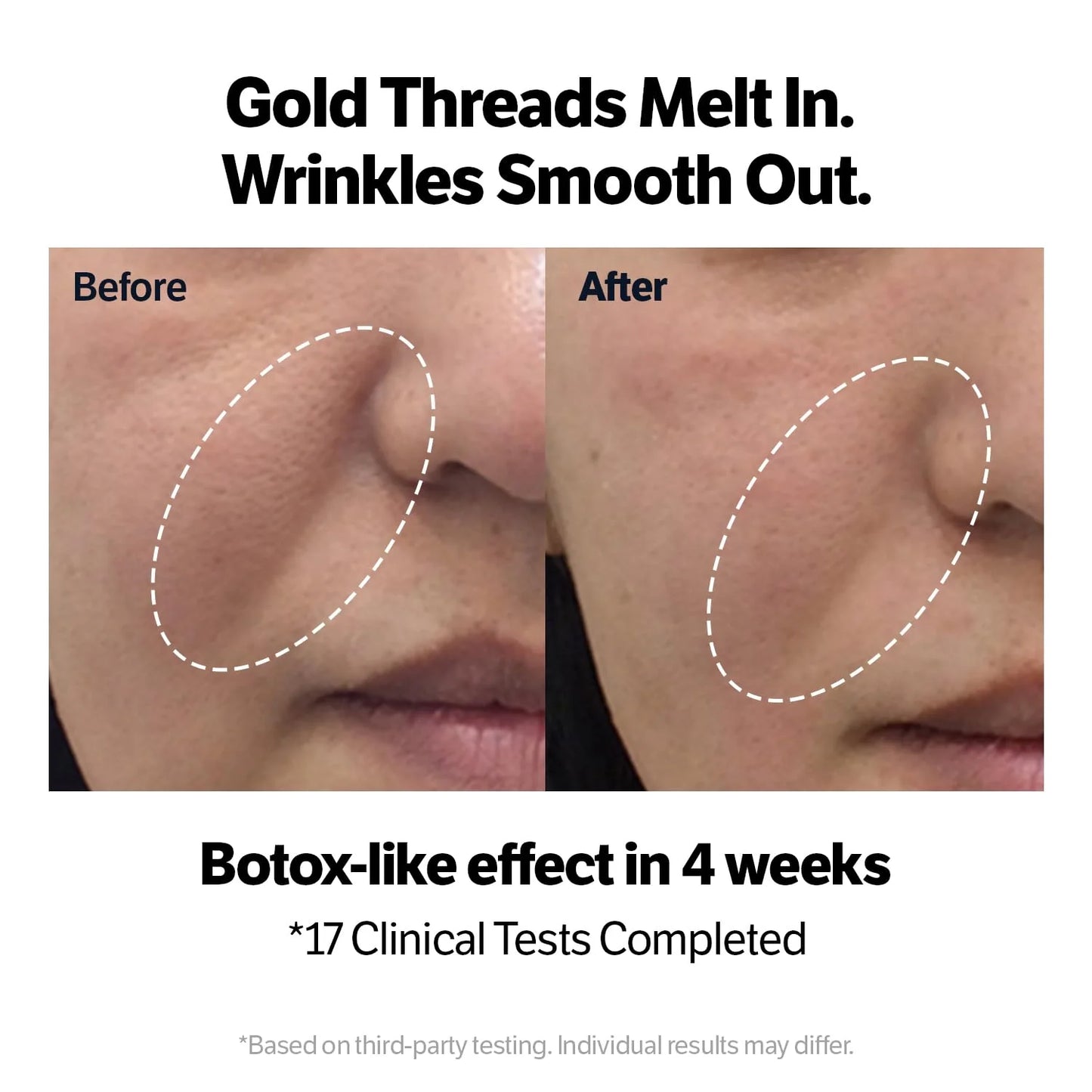 Deep Collagen Silk Peptide Intensive Ampoule (renew) - Αμπούλα με 3-πλό σύστημα lifting