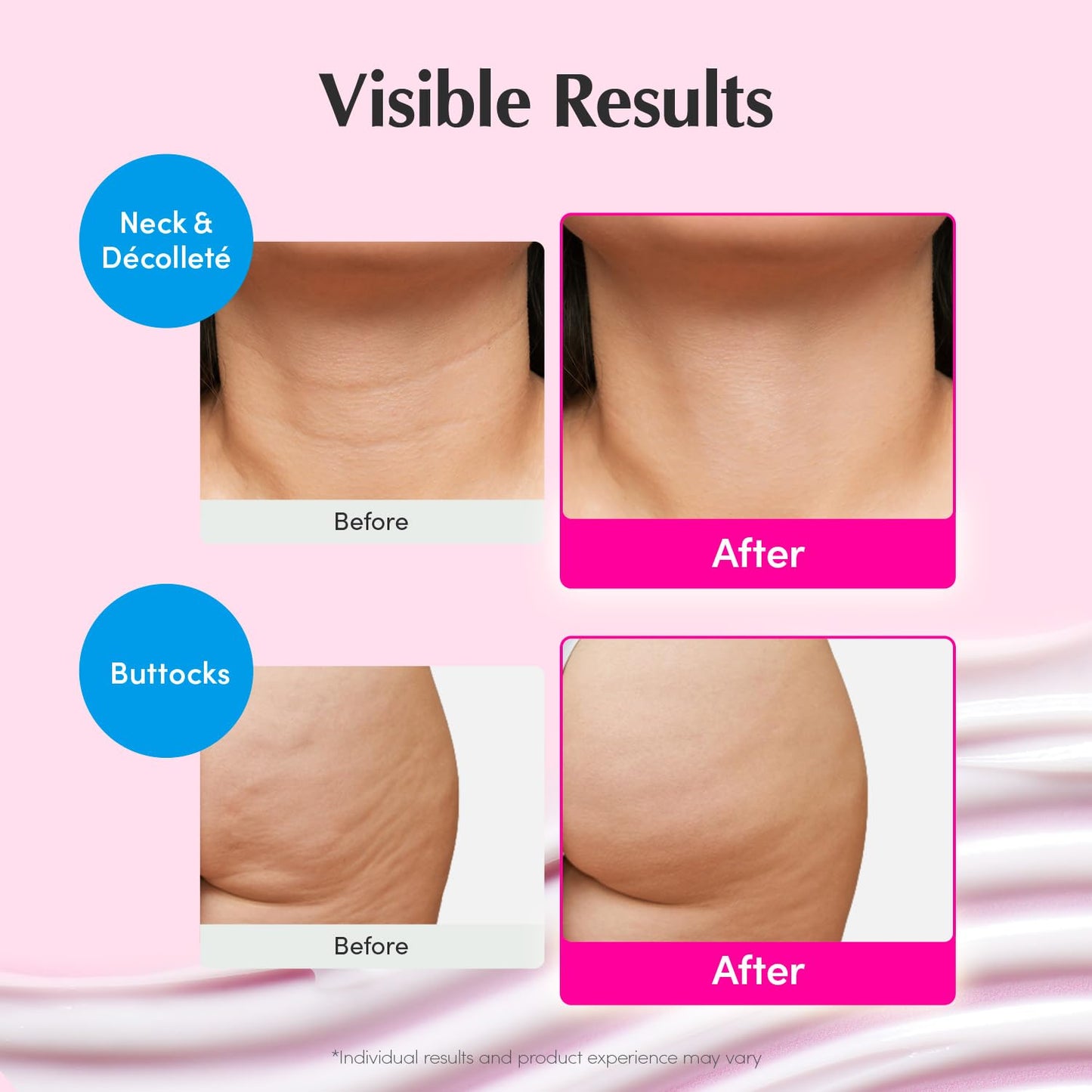 NAD+ Peptide Boosting Cream – Αντιγηραντική Κρέμα Σύσφιξης για Ελαστικότητα & Lifting