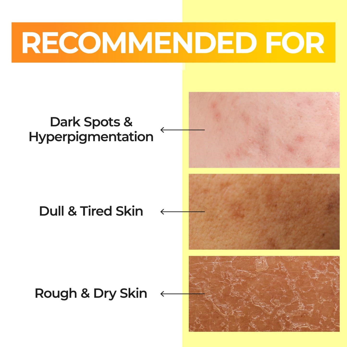 No.5+ Glutathione Vitamin Concentrated Toner - No.5+ Glutathione Vitamin Concentrated Toner – Τονωτική Λοσιόν Προσώπου με Γλουταθειόνη, Βιταμίνη C & Νιασιναμίδη