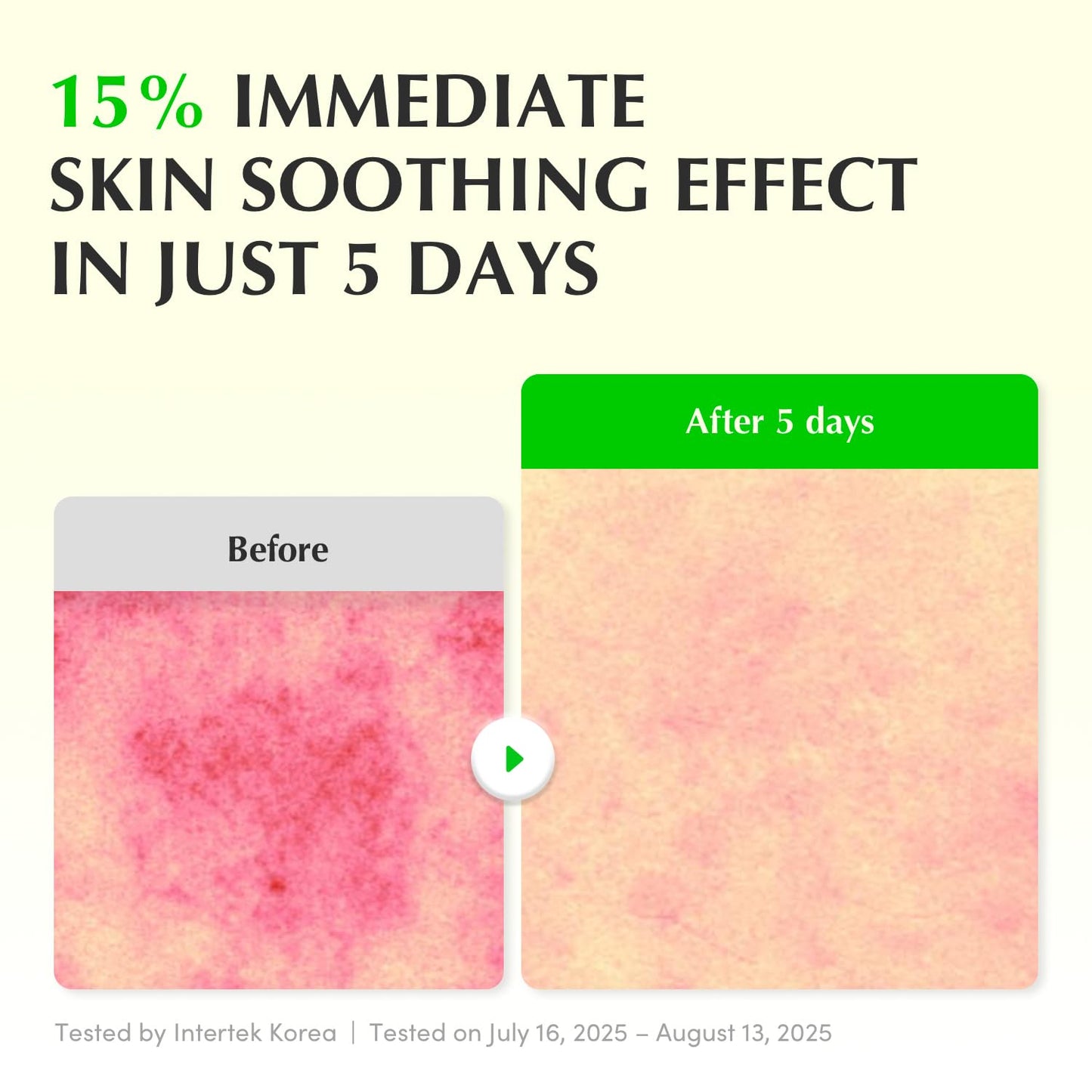 Aloe PDRN Calming Serum - Ορός άμεσης καταπράυνσης με Aloe PDRN & Ceramides