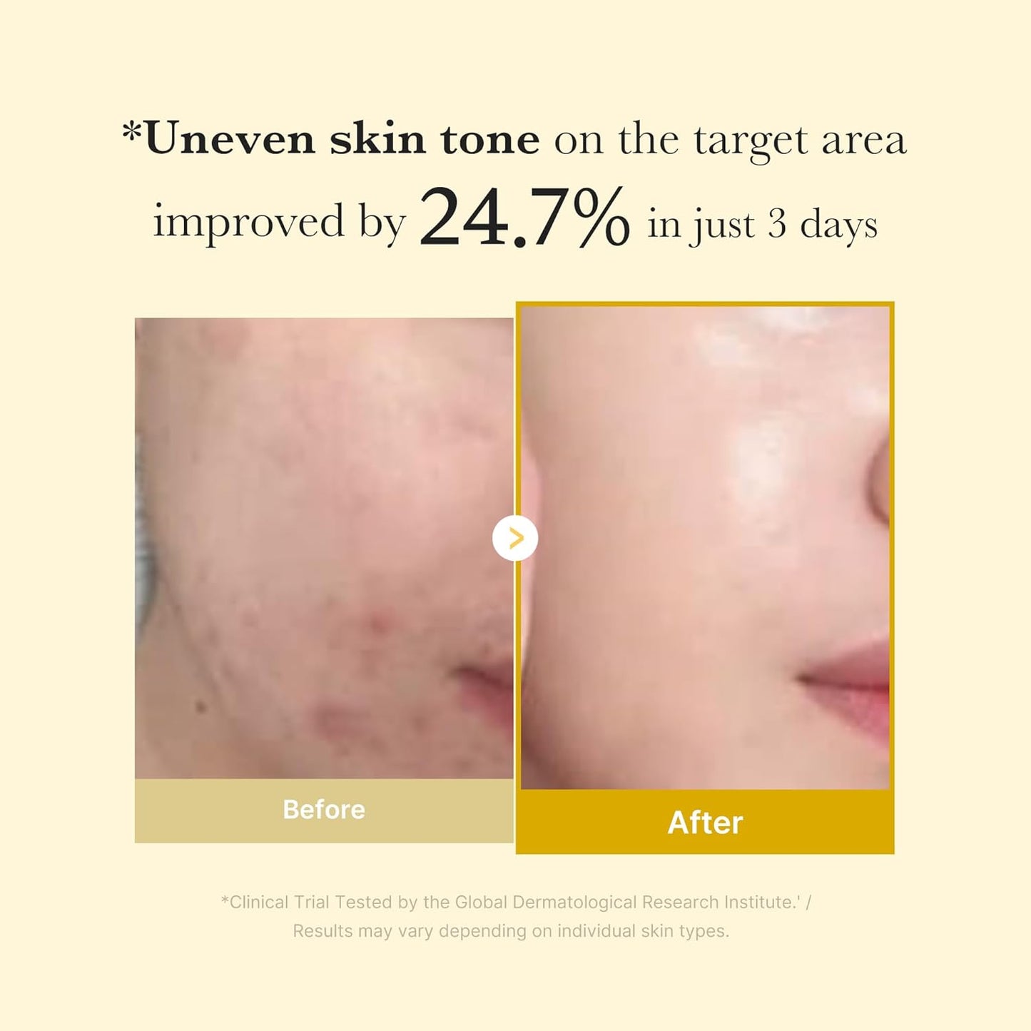 Kojic Acid Turmeric Night Wrapping Mask – Μάσκα Νύχτας Λάμψης & Σύσφιξης με Κοζικό Οξύ & Κουρκουμά