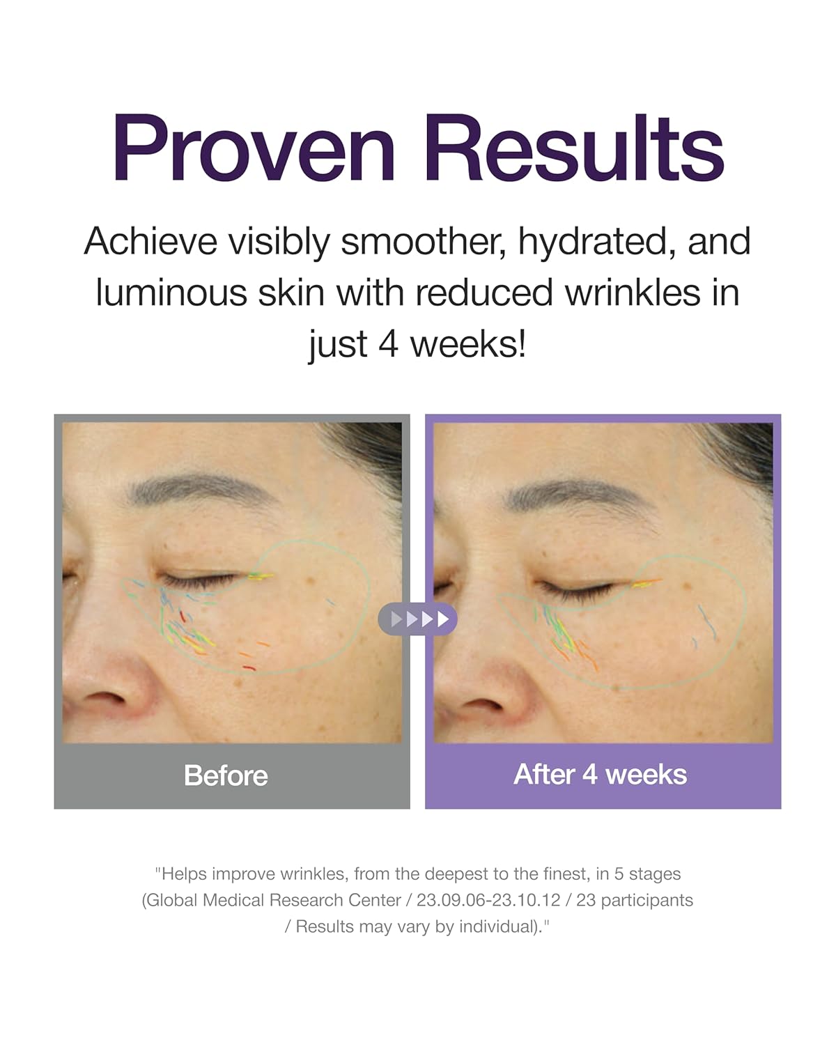 360º Shot PDRN Active Serum - Αντιγηραντικός Ορός Σύσφιξης & Lifting με PDRN και Κολλαγόνο