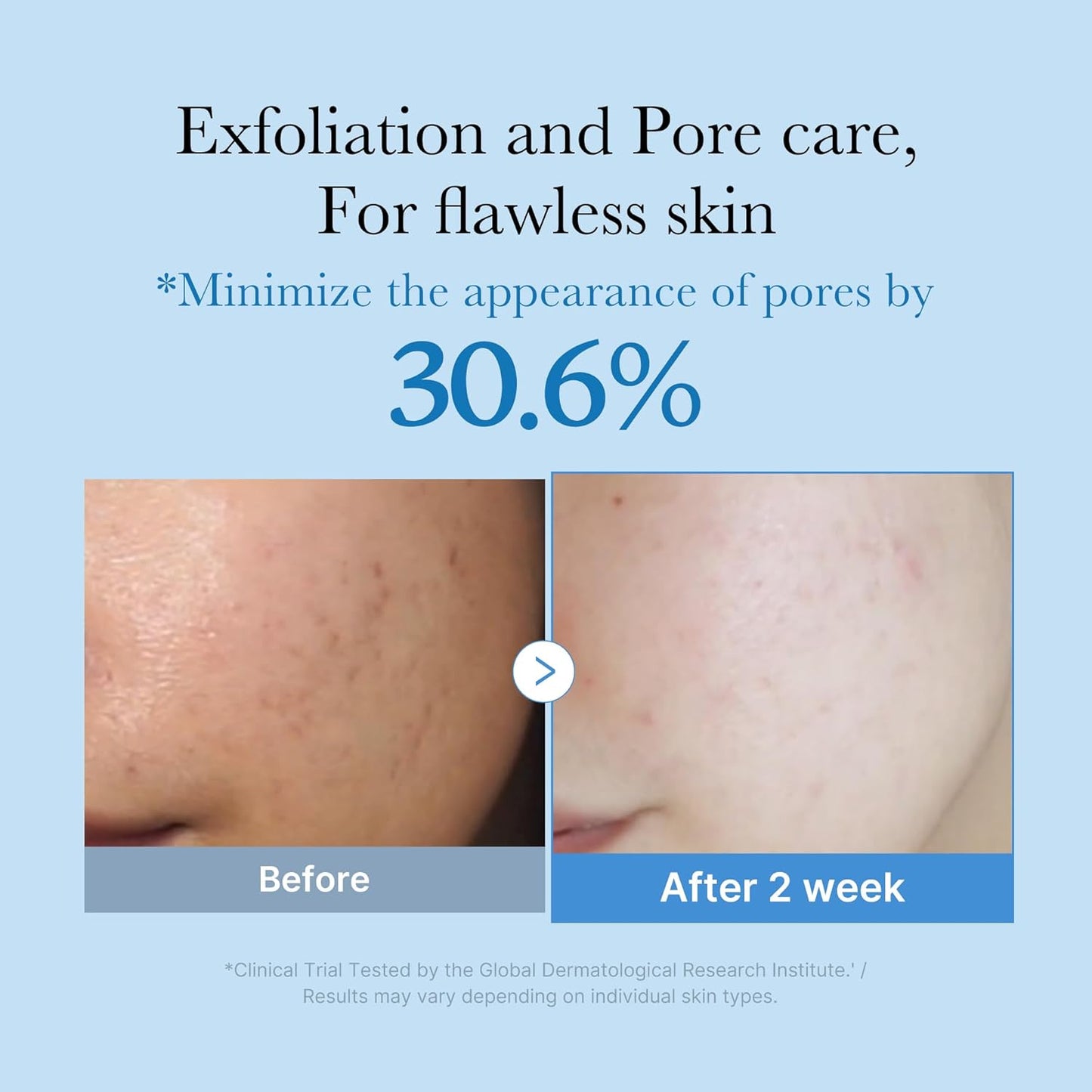 Zero Pore Toner - Toner Σύσφιξης Πόρων & Ενυδάτωσης