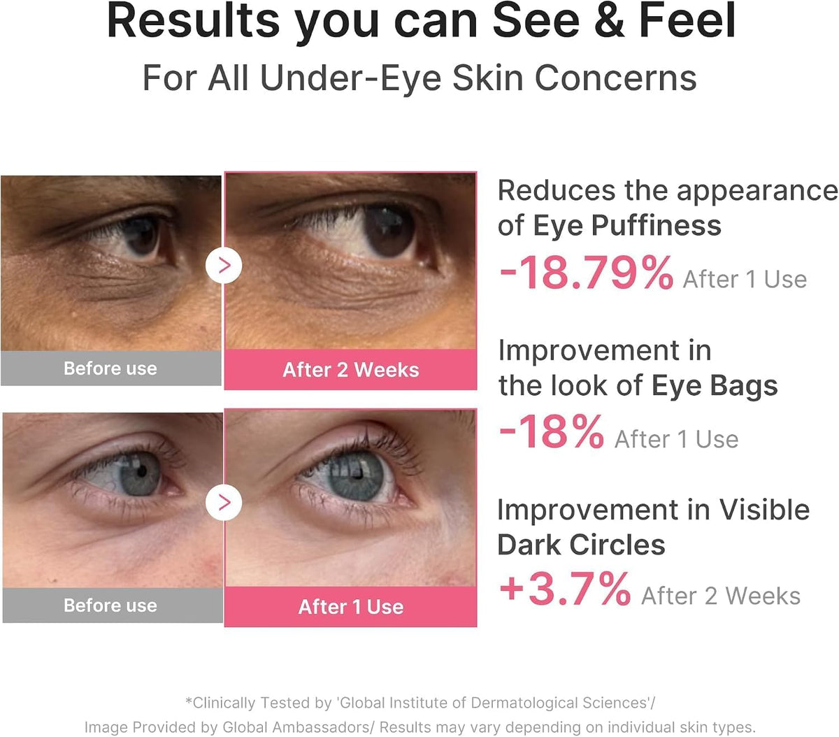 PDRN Pink Caffeine Collagen Eye Patch 60pcs – Hydrogel Patches Ματιών με PDRN, Καφεΐνη & Κολλαγόνο για Σύσφιξη & Αναζωογόνηση