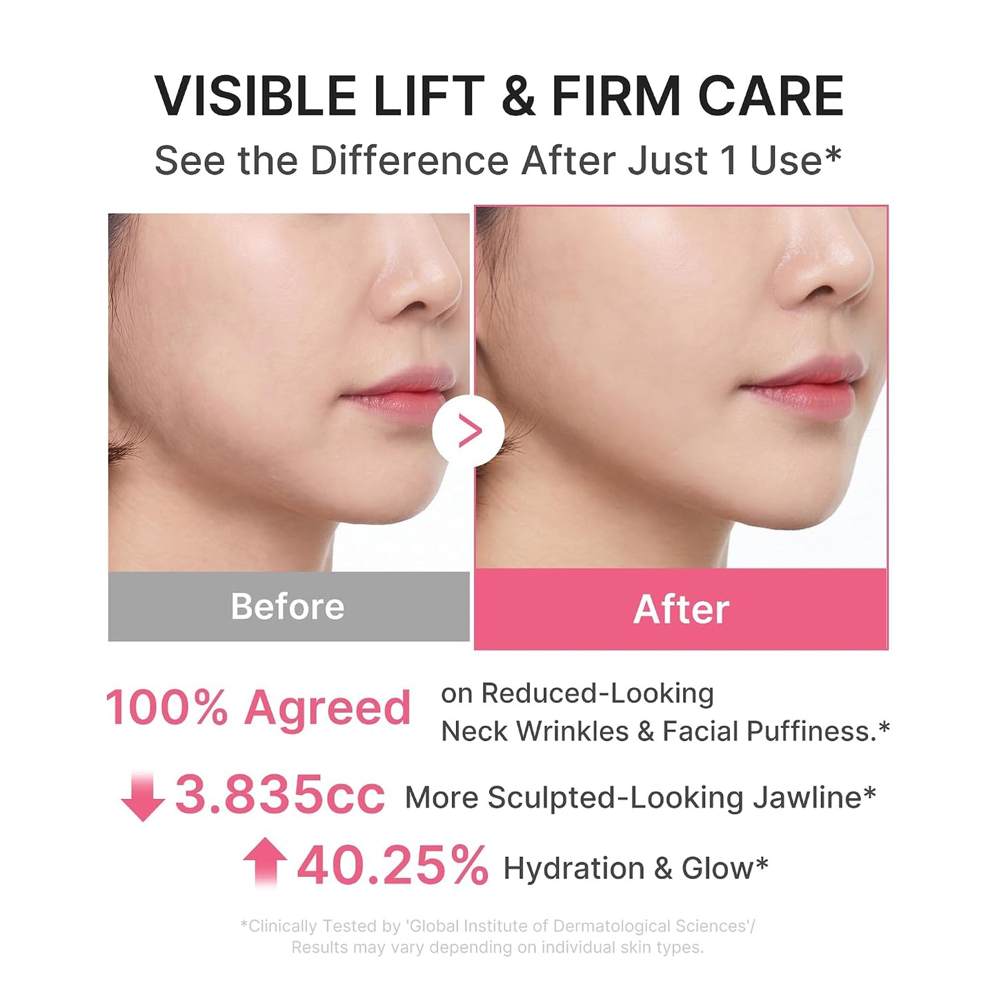 PDRN Collagen Gua Sha Neck Wrinkle Cream – Συσφικτική Κρέμα Λαιμού & Ντεκολτέ με Gua Sha, PDRN, 5% Volufiline & Κολλαγόνο