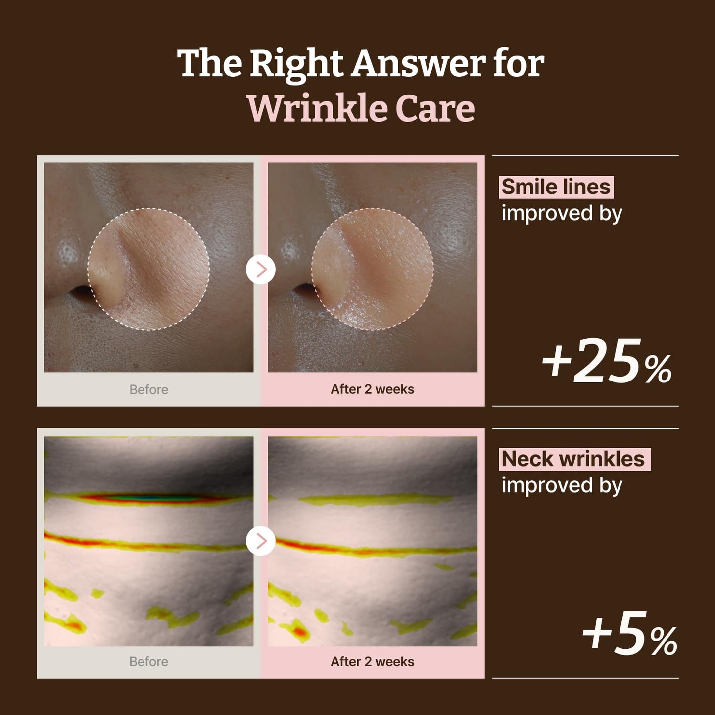 Advanced  PDRN Rejuvenating Mask - Αναζωογονητική Μάσκα Προσώπου & Λαιμού με PDRN, Κολλαγόνο & Πεπτίδια