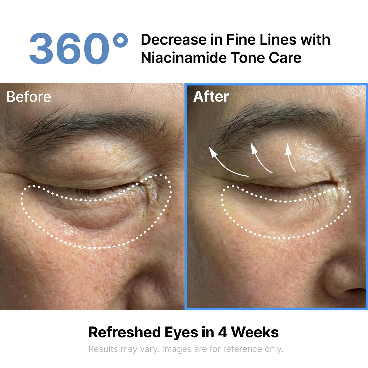 Silk Peptide EGF Intensive Eye Cream - Αντιγηραντική Κρέμα Ματιών με EGF, Ρετινόλη & Πεπτίδια