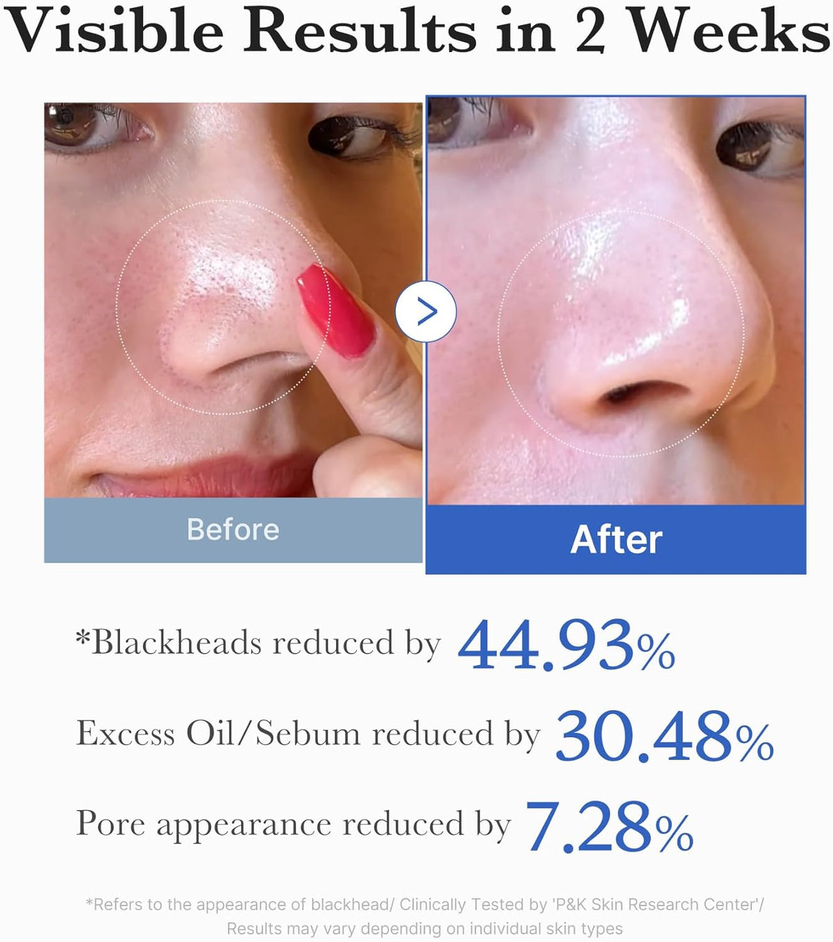 Zero Pore Pad 2.0