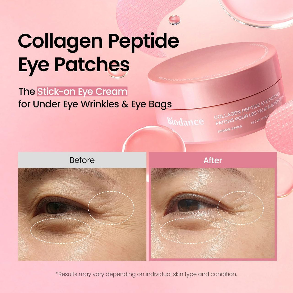 Collagen Eye Patches – Patches Ματιών με Κολλαγόνο, Πεπτίδια & Καφεΐνη