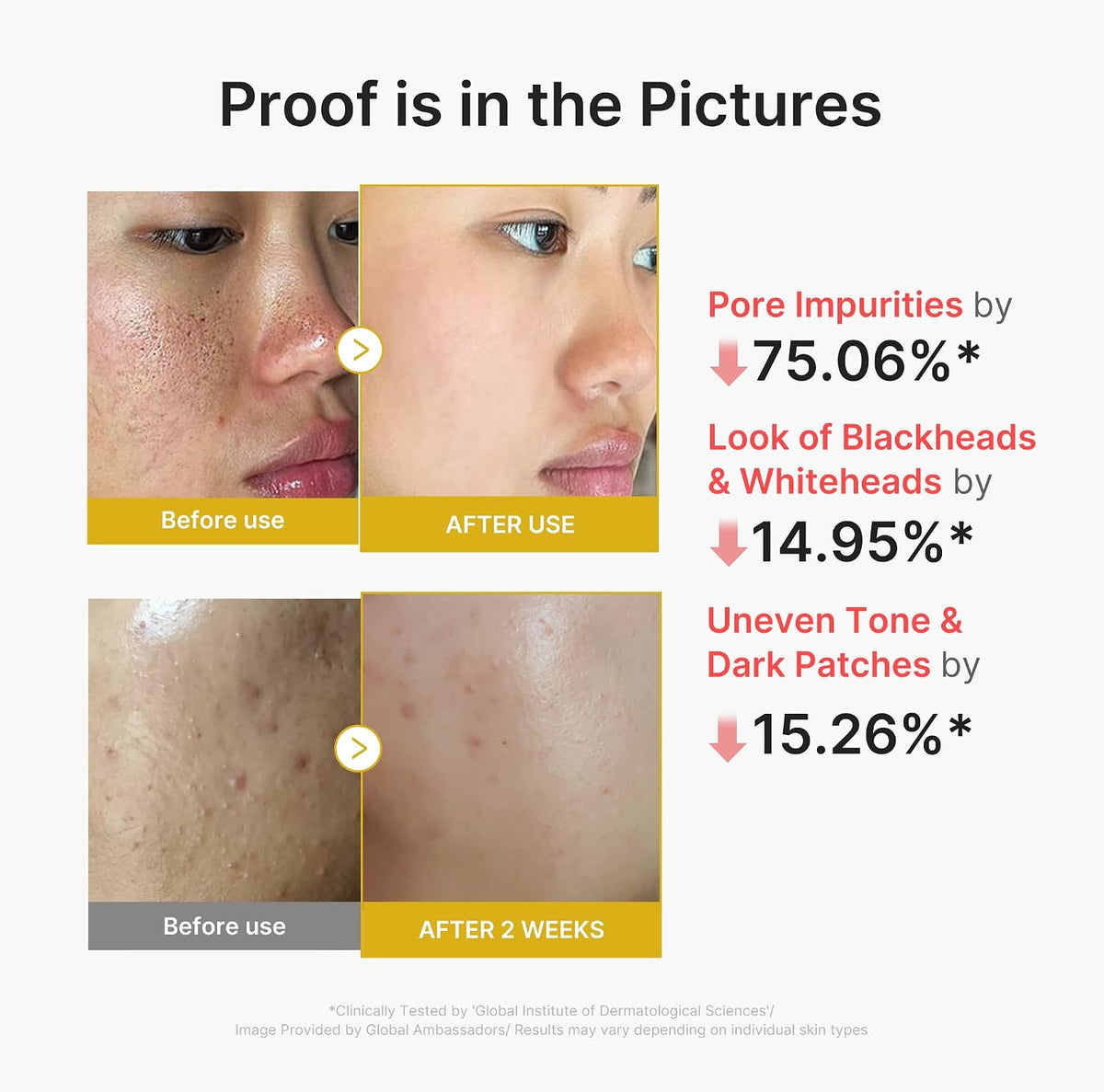 Kojic Acid Turmeric Peel Shot – Απολεπιστικό Προσώπου για Λάμψη, Πόρους & Δυσχρωμίες με Κοτζικό Οξύ, Κουρκουμά & Οξέα