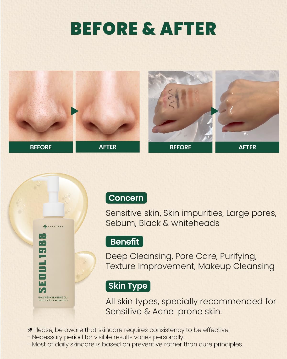 SEOUL 1988 Cleansing Oil : Pine Cica 1% + Probiotics  - Έλαιο καθαρισμού και ντεμακιγιάζ