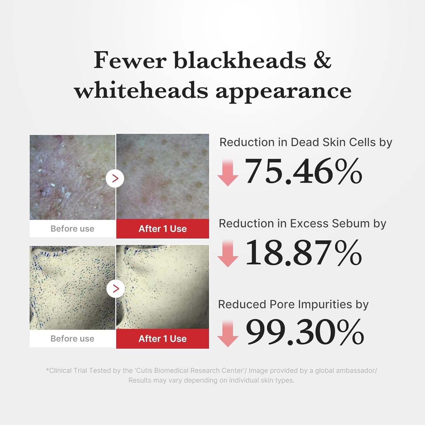 Hypochlorous Acid Peel Shot – Ήπιο Peeling Serum με HOCl & Εκχύλισμα Ρυζιού