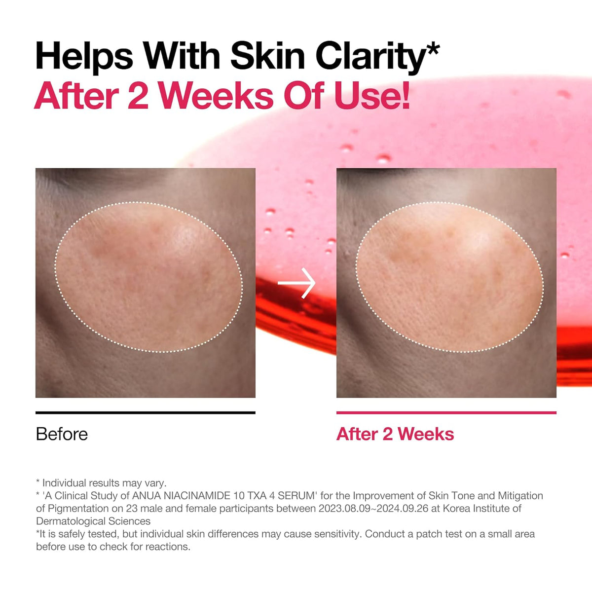 Niacinamide 10% + TXA 4% Serum