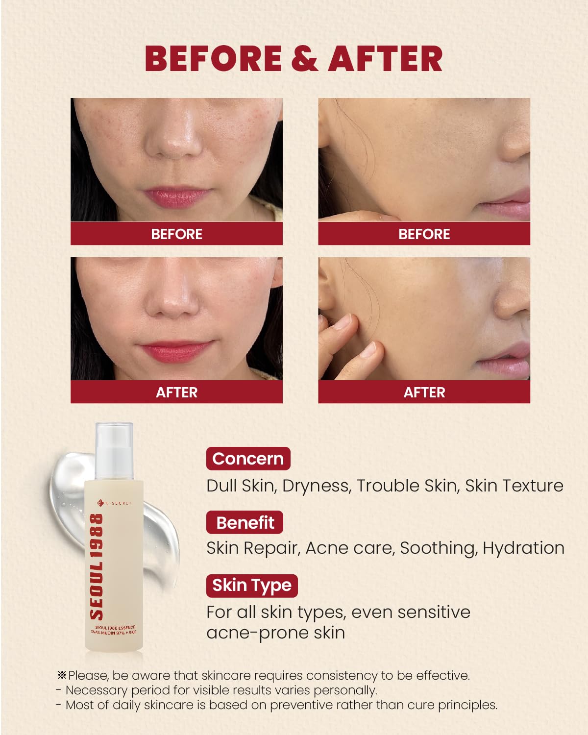 SEOUL 1988 Essence : Snail Mucin 97% + Rice - Ενυδατικό essence για αναζωογόνηση και ανανέωση