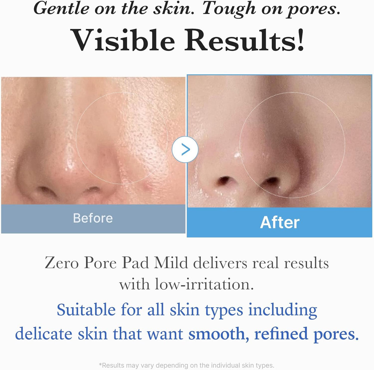 Zero Pore Pad Mild