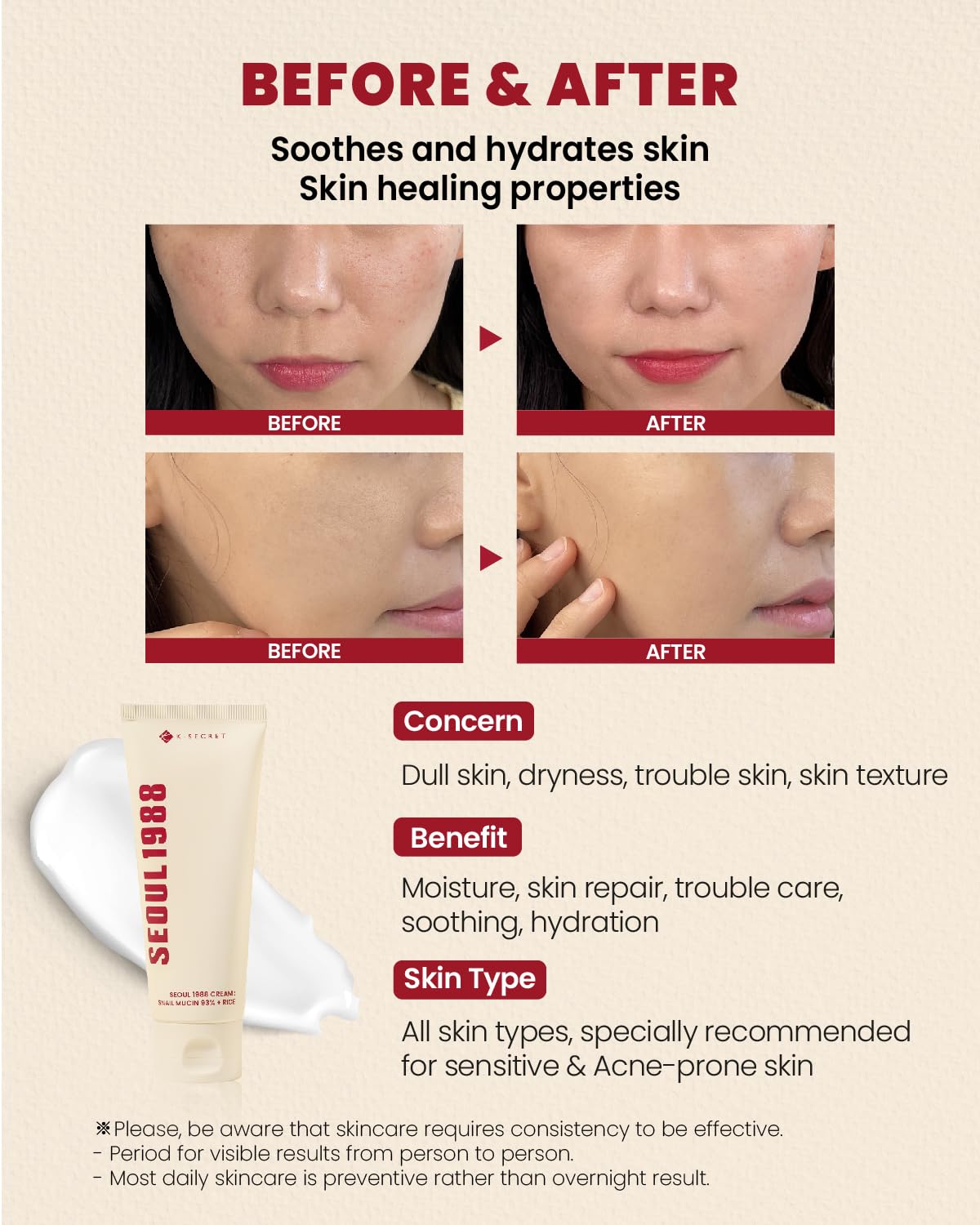 SEOUL 1988 Cream: Snail Mucin 93% + Rice - Ενυδατική κρέμα με έκκριμα σαλιγκαριού