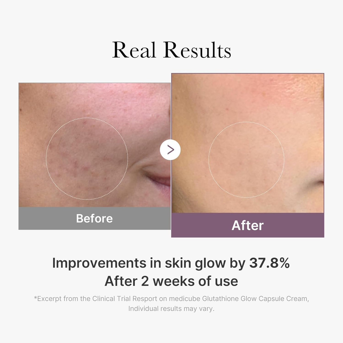 AGE-R Glutathione Glow Capsule Cream - Κρέμα Λάμψης με κάψουλες Γλουταθειόνης