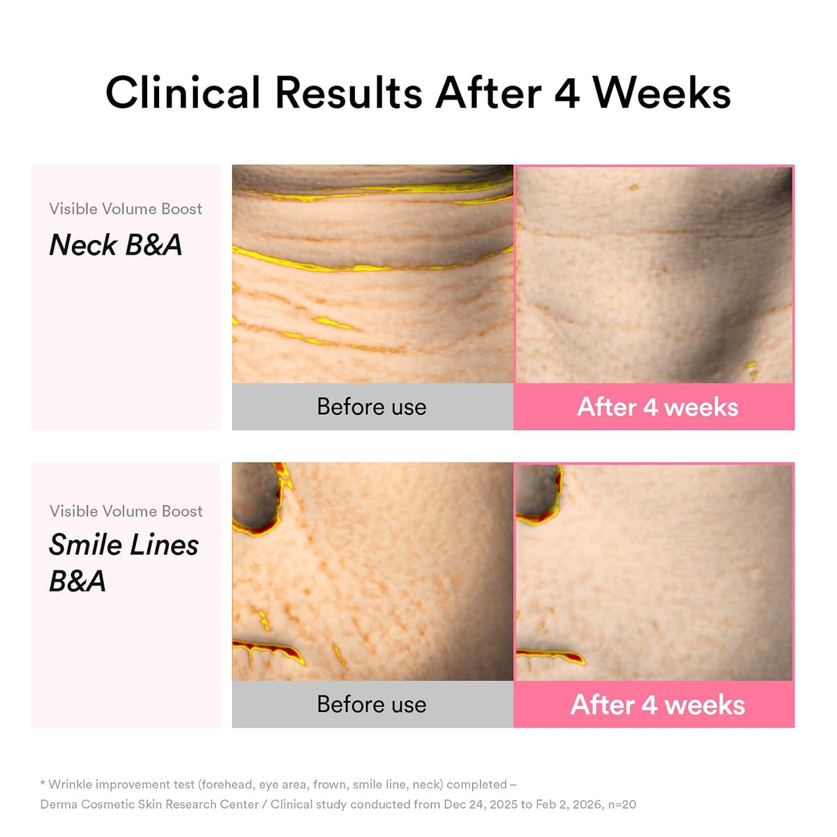 PDRN Volume Fill-it Booster Cream – Κρέμα Σύσφιξης & Όγκου με PDRN, Volufiline & Retinal
