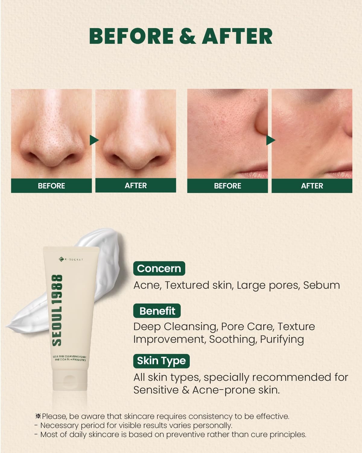 SEOUL 1988 Cleansing Foam : Pine Cica 1% + Probiotics - Αφρός καθαρισμού θρέψης και ενυδάτωσης