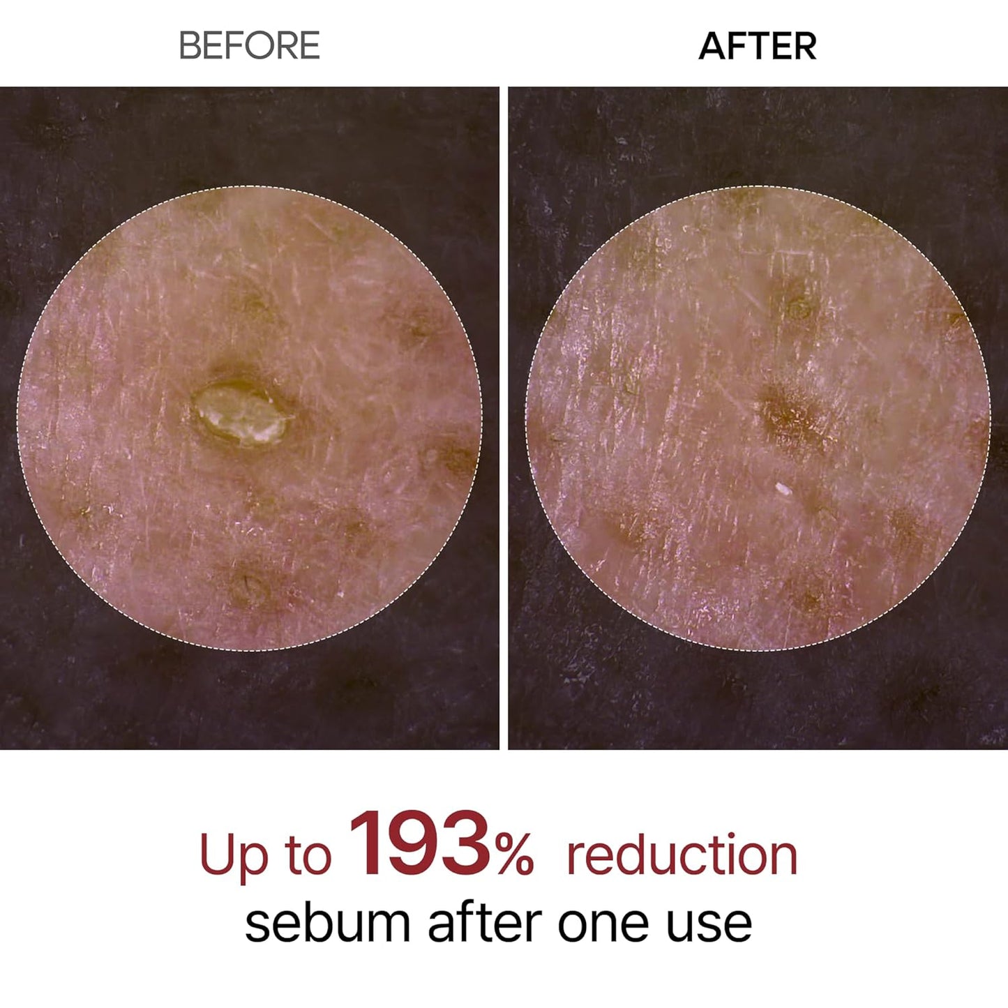 Peel Shot Exfoliant Black Rice Ampoule - Ορός Απολέπισης & Λάμψης