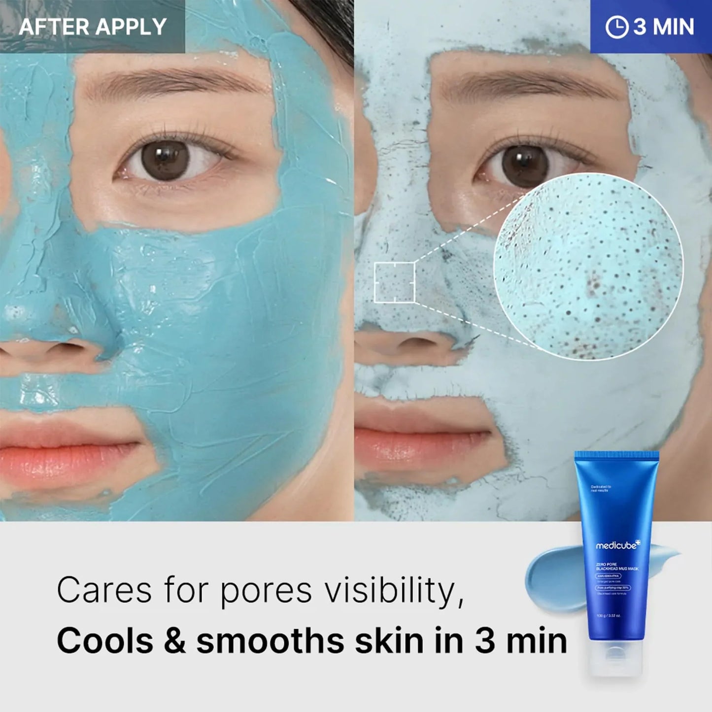 Zero Pore Blackhead Mud Mask - Μάσκα Αποτοξίνωσης με Άργιλο