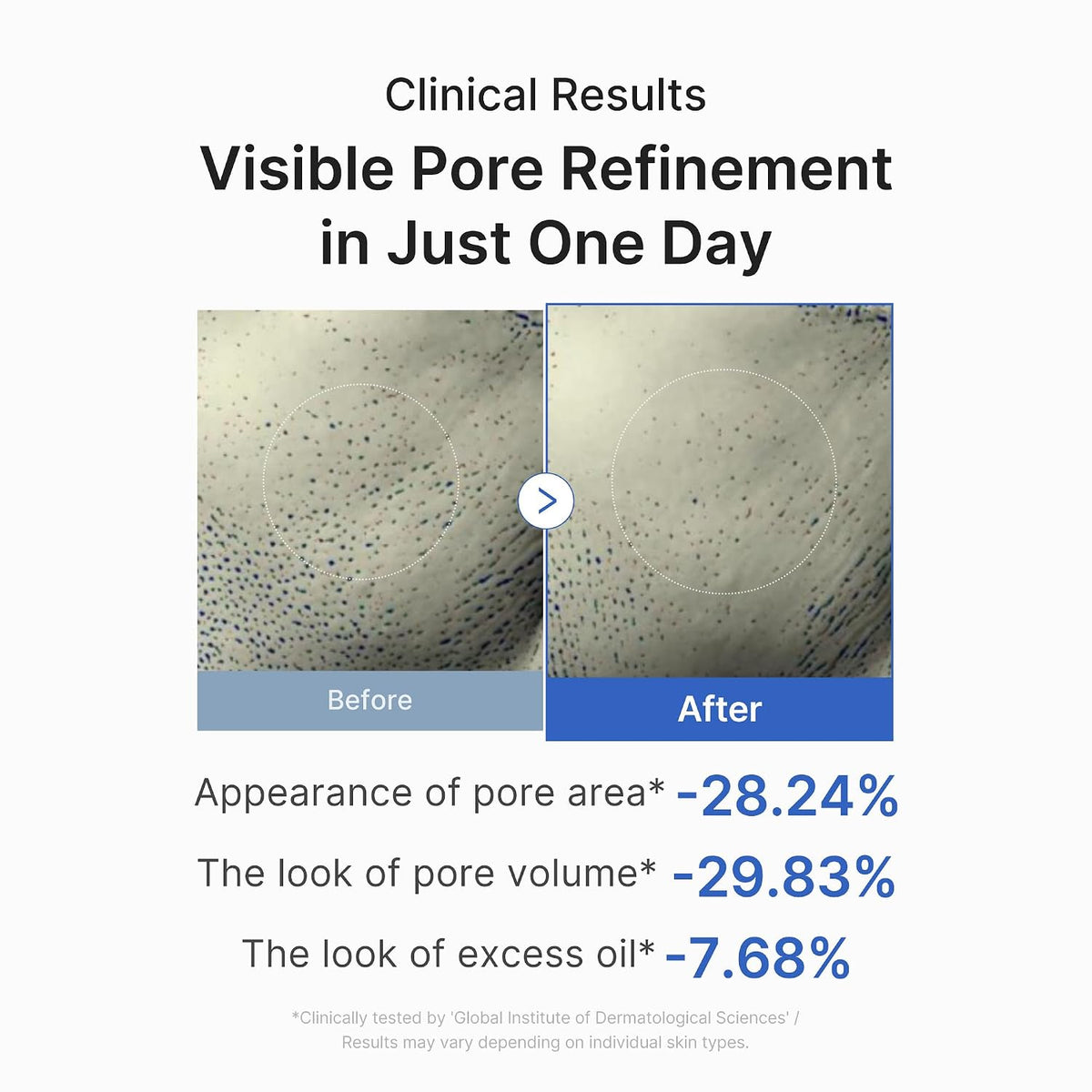 Zero Pore One Day Peptide Serum – Ορός Προσώπου για Σύσφιξη Πόρων, Λείανση & Ρύθμιση Λιπαρότητας με 10 Πεπτίδια & AHA/BHA/PHA/LHA
