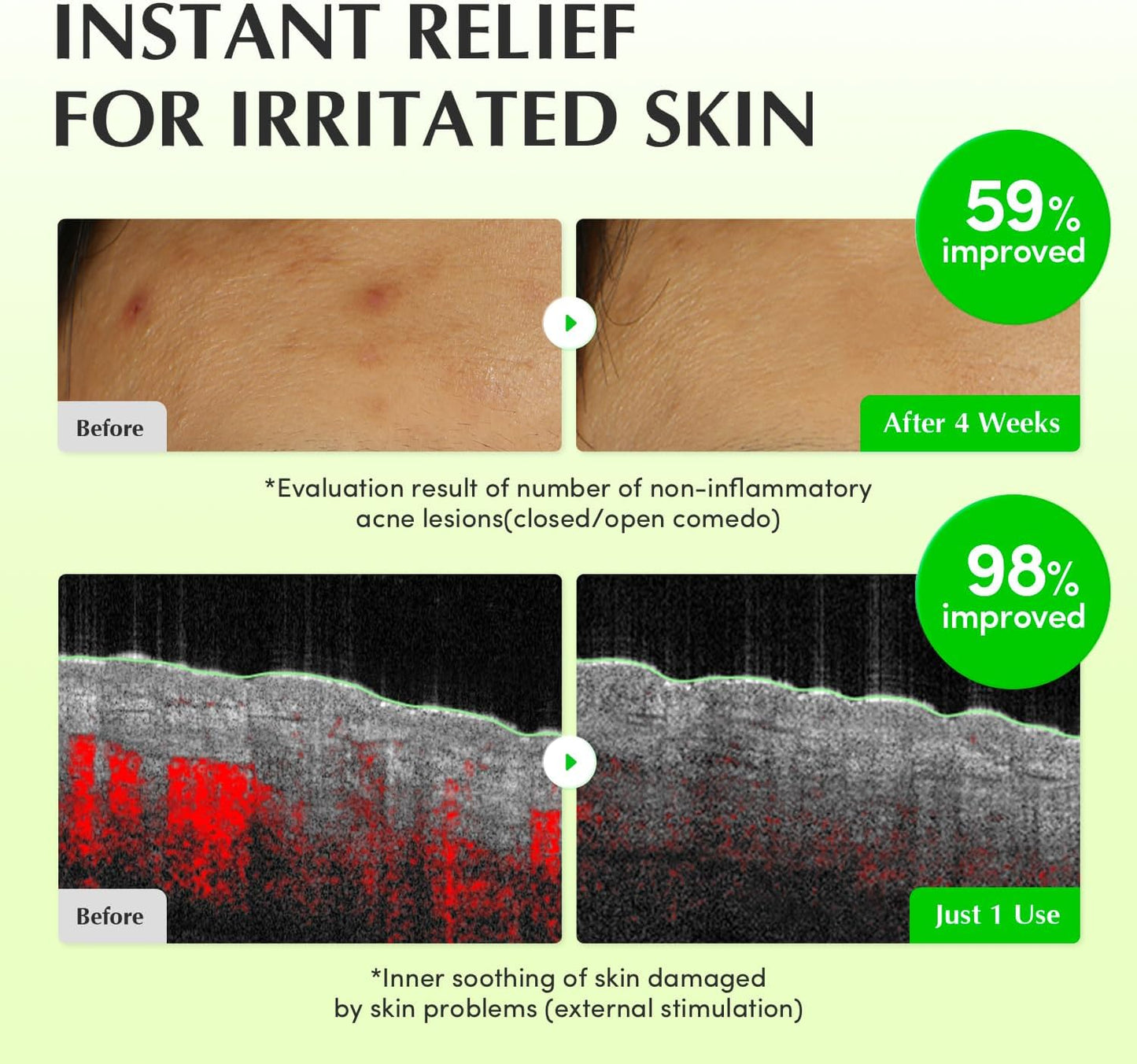 Aloe PDRN Calming Toner – Καταπραϋντική & Ενυδατική Τονωτική Λοσιόν