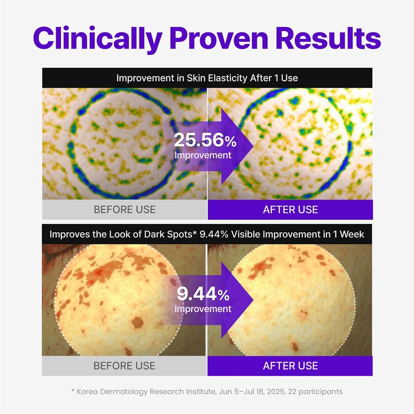 Expert Madeca Cream Active Renew PDRN - Αναπλαστική & Συσφιγκτική Κρέμα Προσώπου με TECA & PDRN