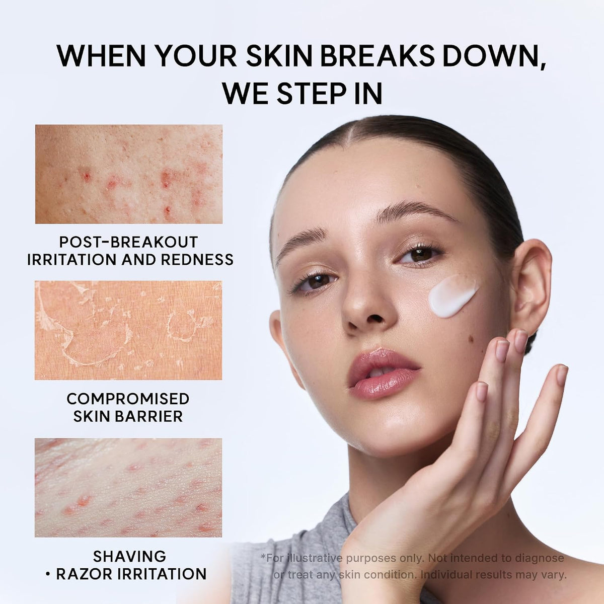 Eraser Soothing Cream – Καταπραϋντική Κρέμα Προσώπου για Ενυδάτωση & Ενίσχυση του Επιδερμικού Φραγμού με Centella & Ceramides