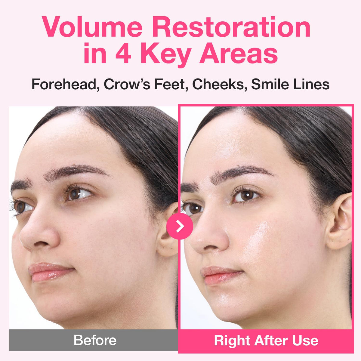 No.2 Rose PDRN Collagen Plumping Sheet Mask – Μάσκα Προσώπου για Σύσφιξη, Ενυδάτωση & Plumping με PDRN και Κολλαγόνο