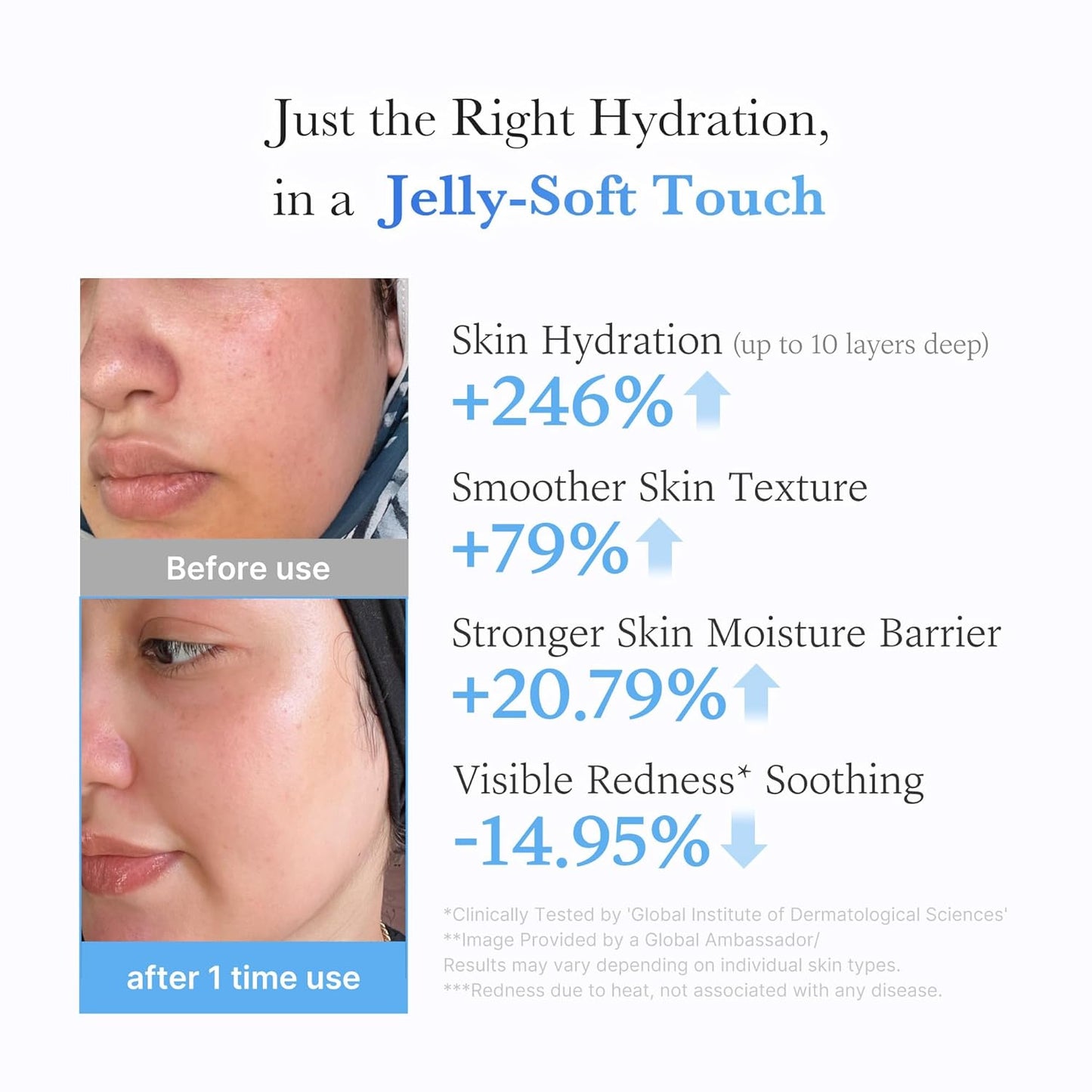 Hyaluronic Ceramide Jelly Cream – Ενυδατική Jelly Κρέμα για Λάμψη και Ενίσχυση του Επιδερμικού Φραγμού