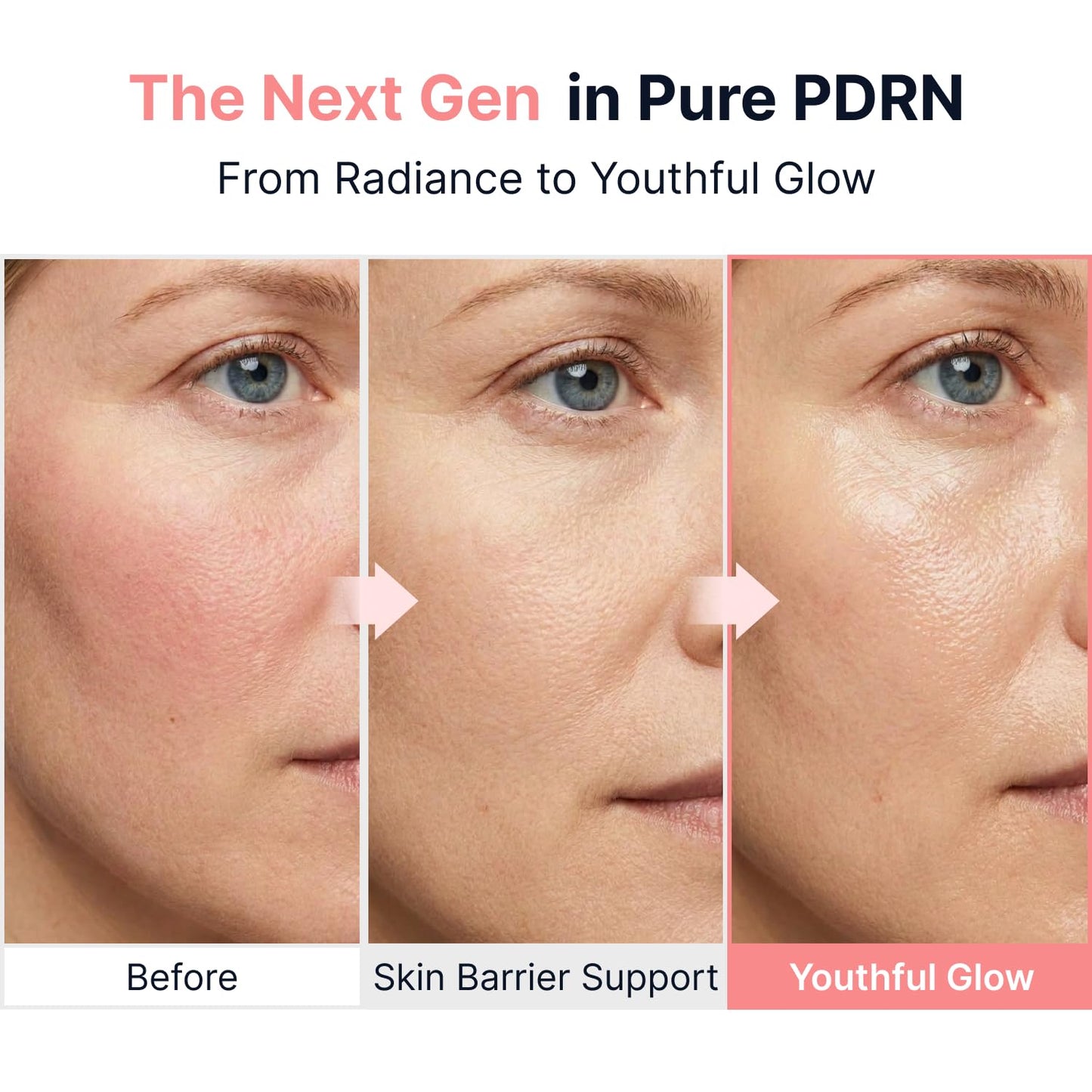 Pink PDRN Glow Boosting Ampoule 40ml – Αμπούλα Λάμψης & Ελαστικότητας με PDRN
