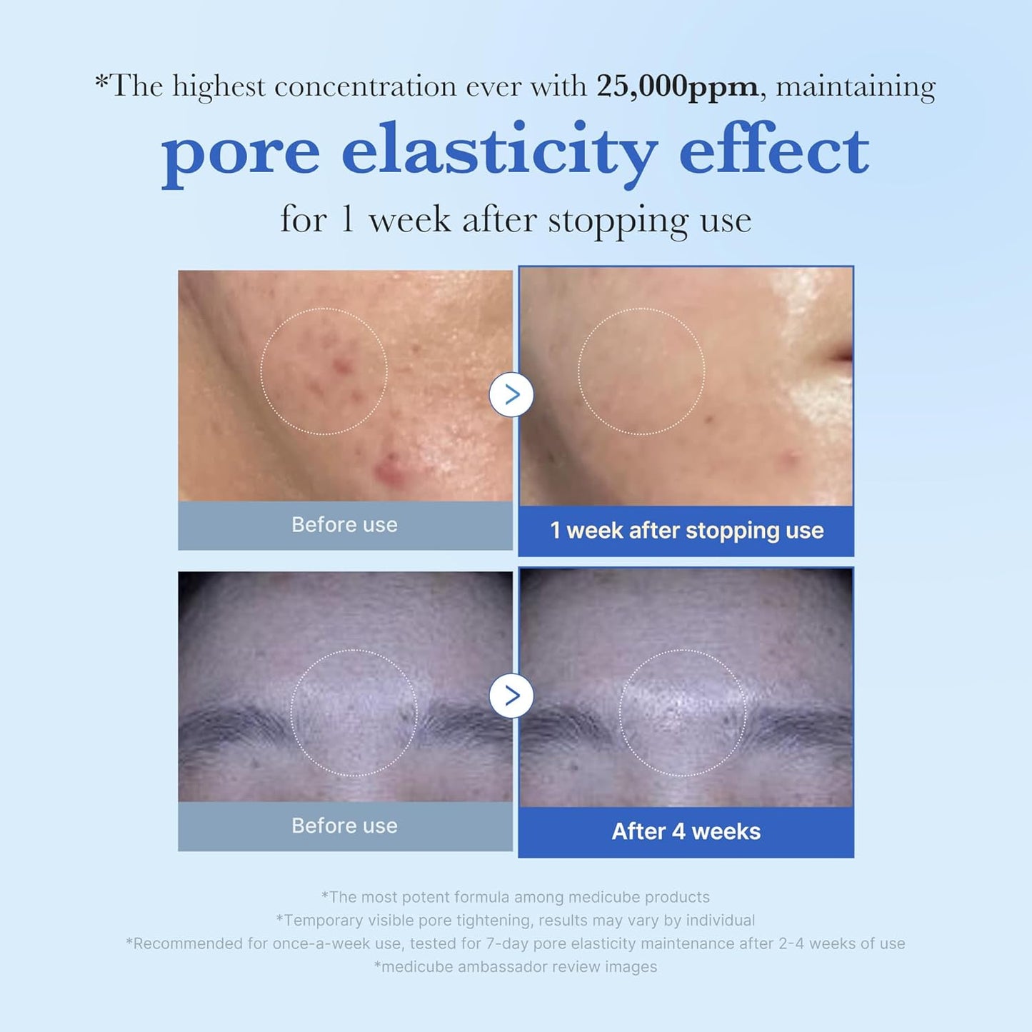 One Day Exosome Shot Pore Serum 25000 - Ορός micro-needling για λεία υφή & φωτεινό δέρμα