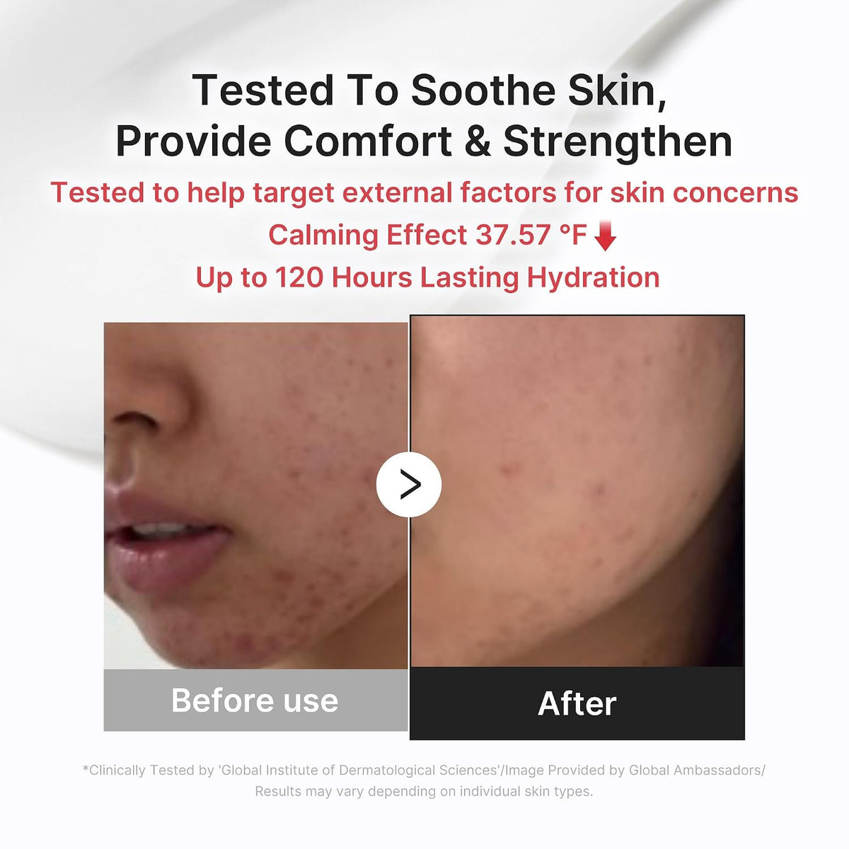Hypochlorous 3H Relief Cream – Καταπραϋντική Κρέμα Ενυδάτωσης για Ευαίσθητη Επιδερμίδα & Ενίσχυση του Επιδερμικού Φραγμού
